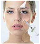 Kreuz 1ml 1.1ml verband Hyaluronsäure-Hautfüller für Nase Midface-Backe