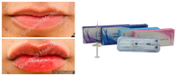 Verringerung von Falten Entfernen von Marionetten Hyaluronsäure Injektionsfiller Linien Lippen Nasenfiller