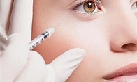 Hyaluronsäure Lippengel Injektionen Augenfalten Synthetische Hyaluronsäure Hautfüllmittel