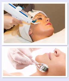 Hyaluronsäure Mesotherapy-Einspritzung
