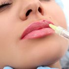 Gel-stellen verbundener Hyaluronsäure-Querfüller für Lippen Brust-Hinterteil-Einspritzung gegenüber