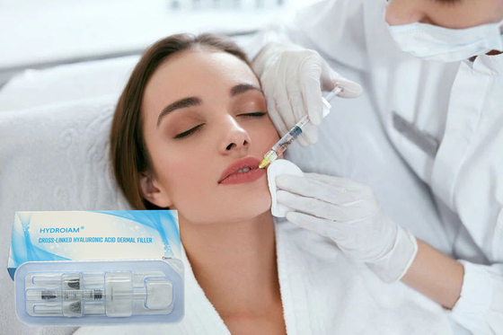 Nicht chirurgische Lippenverbesserungs-Füller-Hyaluronsäure-Lippeneinspritzungen