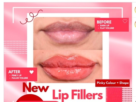 Vergrößern Sie Ihre Lippen mit RED Patent Lippenfüller