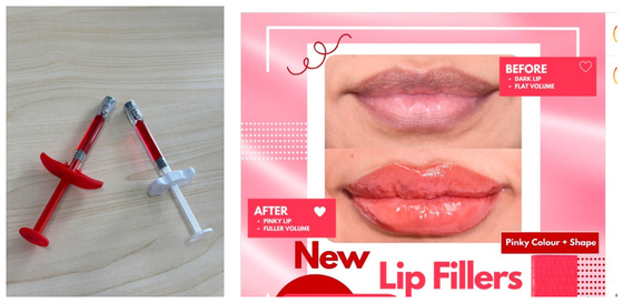 Hautfüllmittel für die Lippen, sicher und wirksam für Mediziner