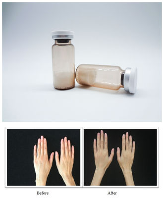 Sterile Füllstoffe für das Gesicht PLLA Hyaluronsäure Injektionsgel für die glatte Faltenkorrektur und die Wiederherstellung des Volumens des Gesichts