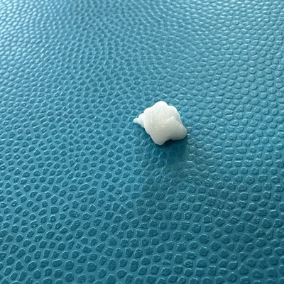 Fortgeschrittene Füllwirkung auf Marionettenlinien mit Calciumhydroxyapatit-Injektion
