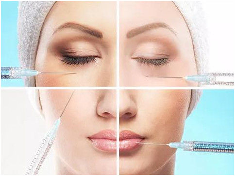 Sterile, mit Hyaluronsäure verknüpfte Hautfüllung für natürlich aussehende Gesichtskontur und Hautverjüngung